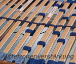 Mittelzonenverstärkung